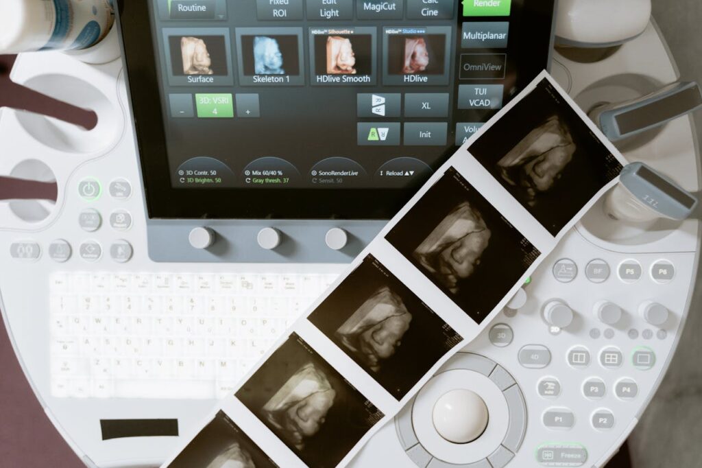 Free stock photo of 3d scanning, 3d ultrasound, anatomy